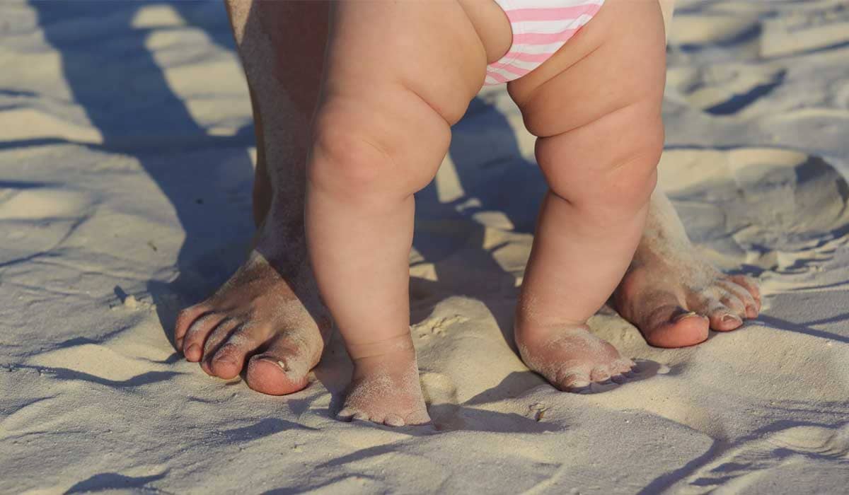 Read more about the article Children with bow legs- when to see a doctor ?